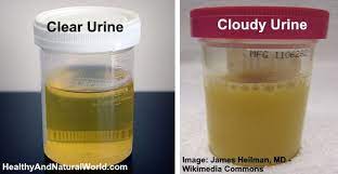 Cloudy Urine
